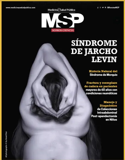 Síndrome de Jarcho Levin