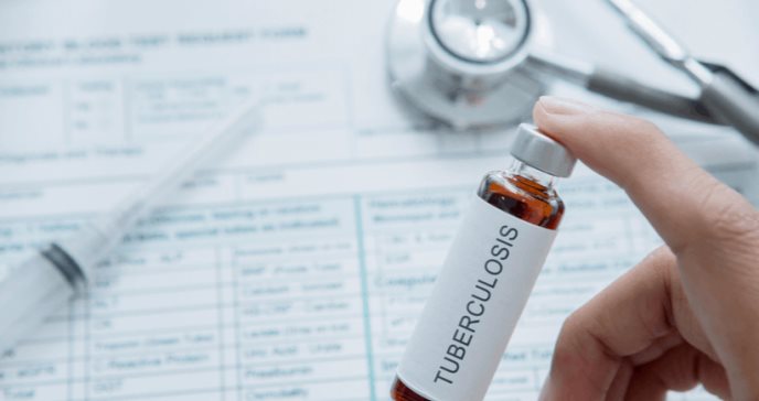 Nueva vacuna para prevenir la tuberculosis está cada vez más cerca