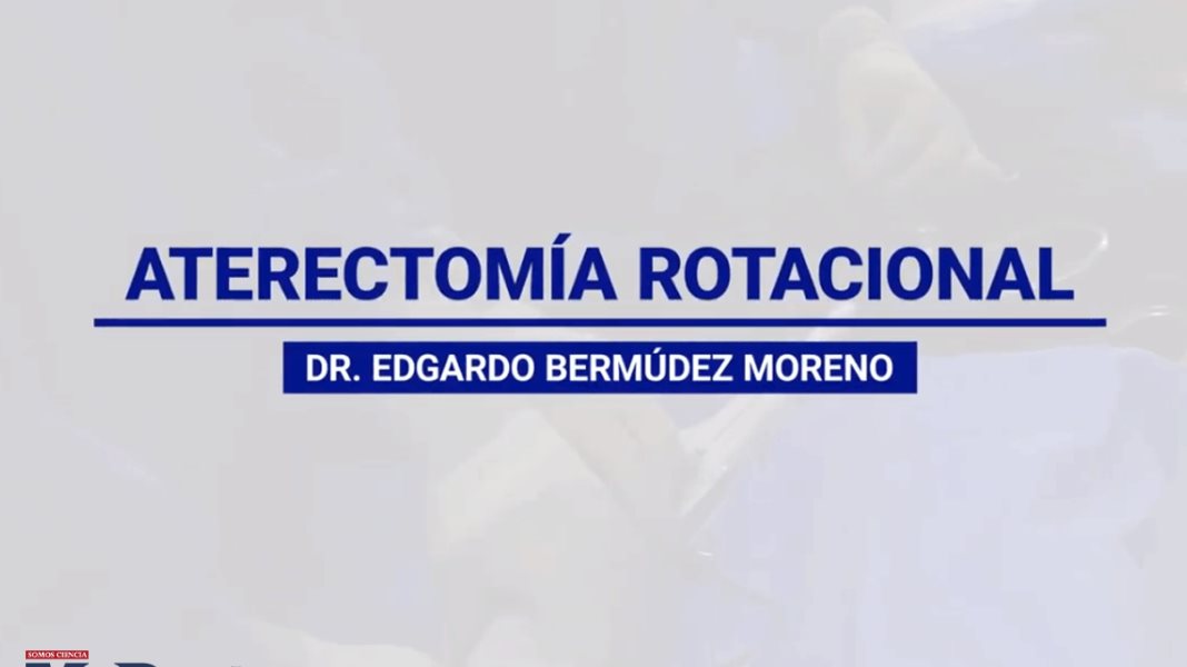 Procedimiento de Aterectomía Rotacional desde el Centro Médico Episcopal San Lucas