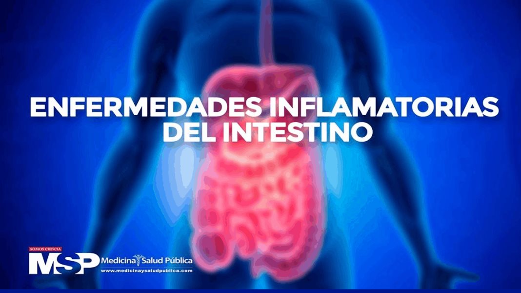 Enfermedades Inflamatorias del Intestino