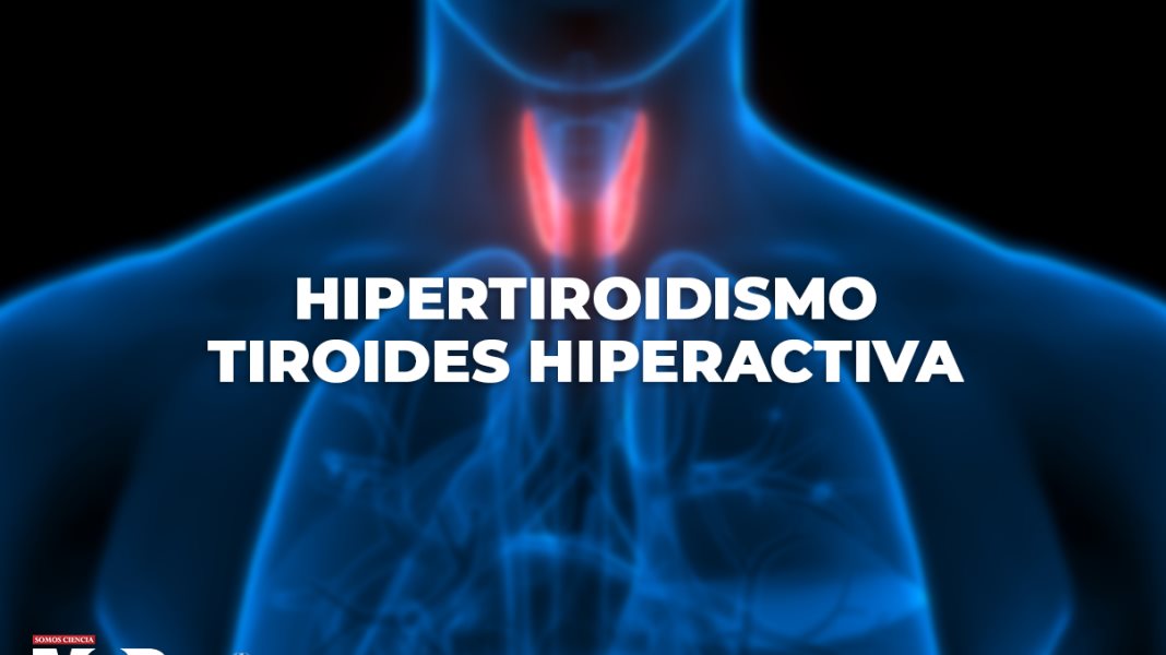Tiroides y su dramático impacto en el cuerpo