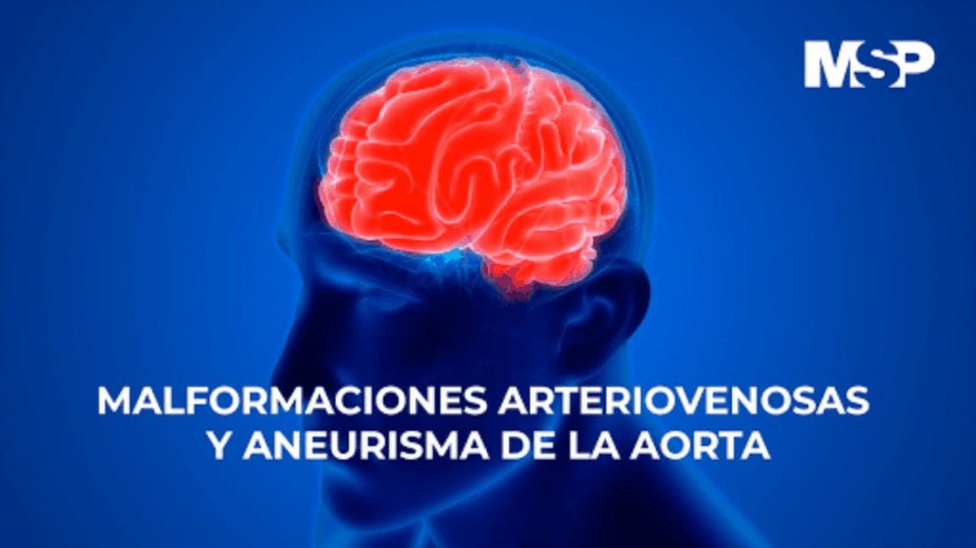 Malformaciones arteriovenosas y aneurisma de la aorta