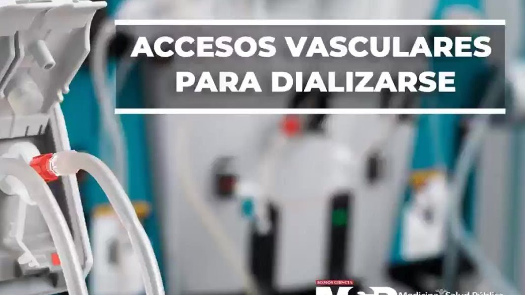 Accesos vascular para diálisis