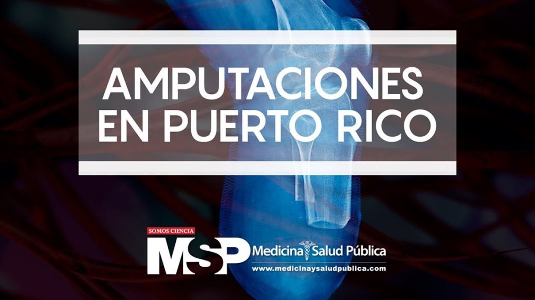 Amputaciones en Puerto Rico