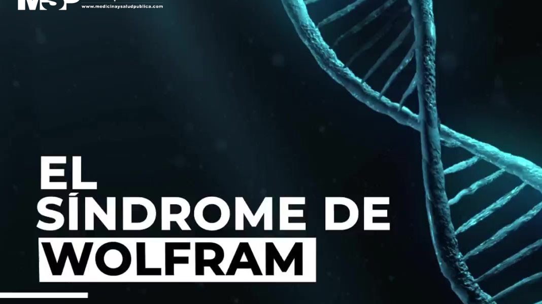El síndrome de Wolfram