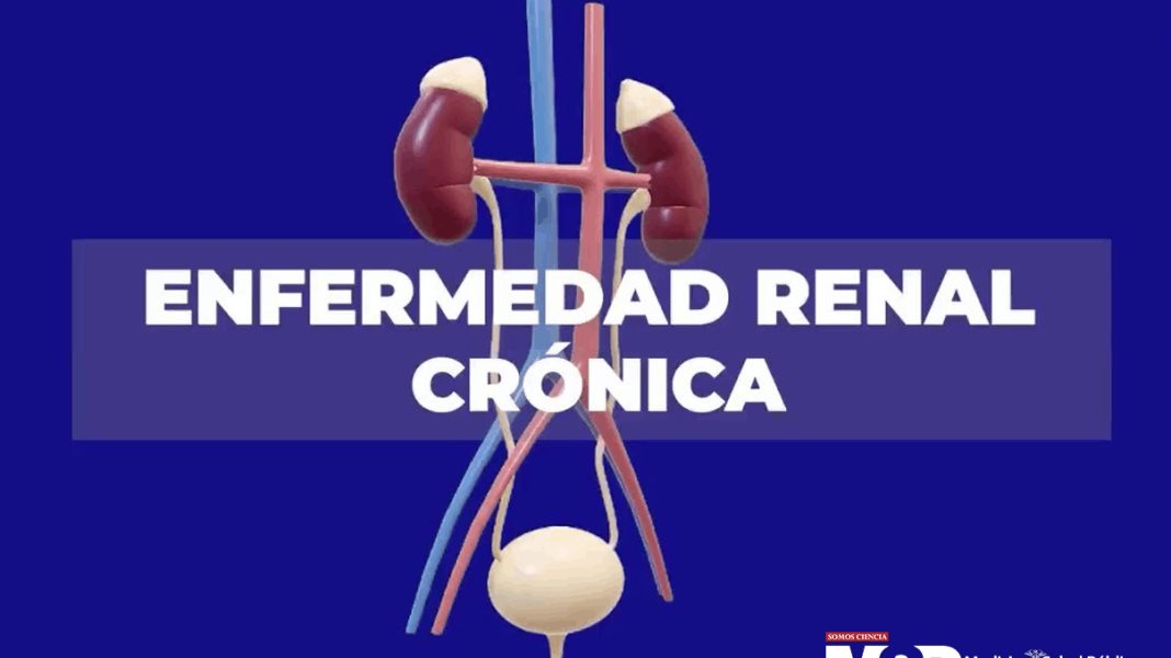 Enfermedad renal crónica