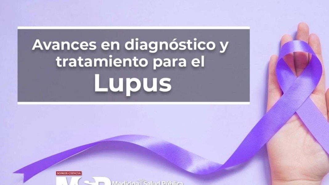Avances en diagnóstico y tratamiento para el lupus