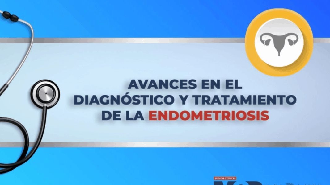 Avances en el diagnóstico y tratamiento de la endometriosis
