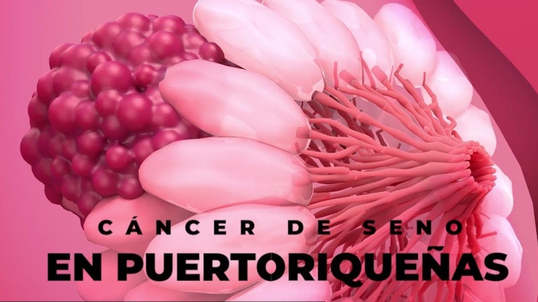 Cáncer de seno en puertorriqueñas