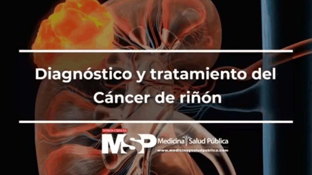 Diagnóstico y tratamiento del Cáncer de riñón