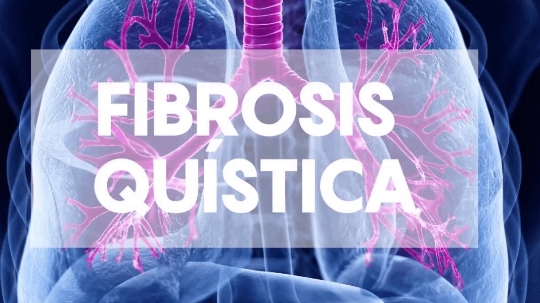 Fibrosis Quística