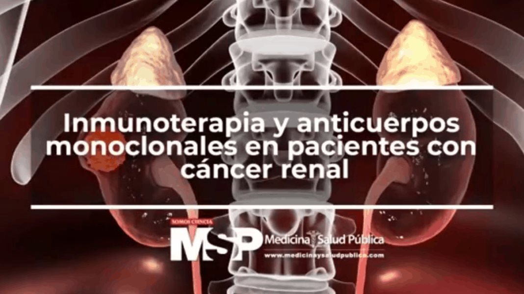 Inmunoterapia y anticuerpos monoclonales en pacientes con cáncer renal
