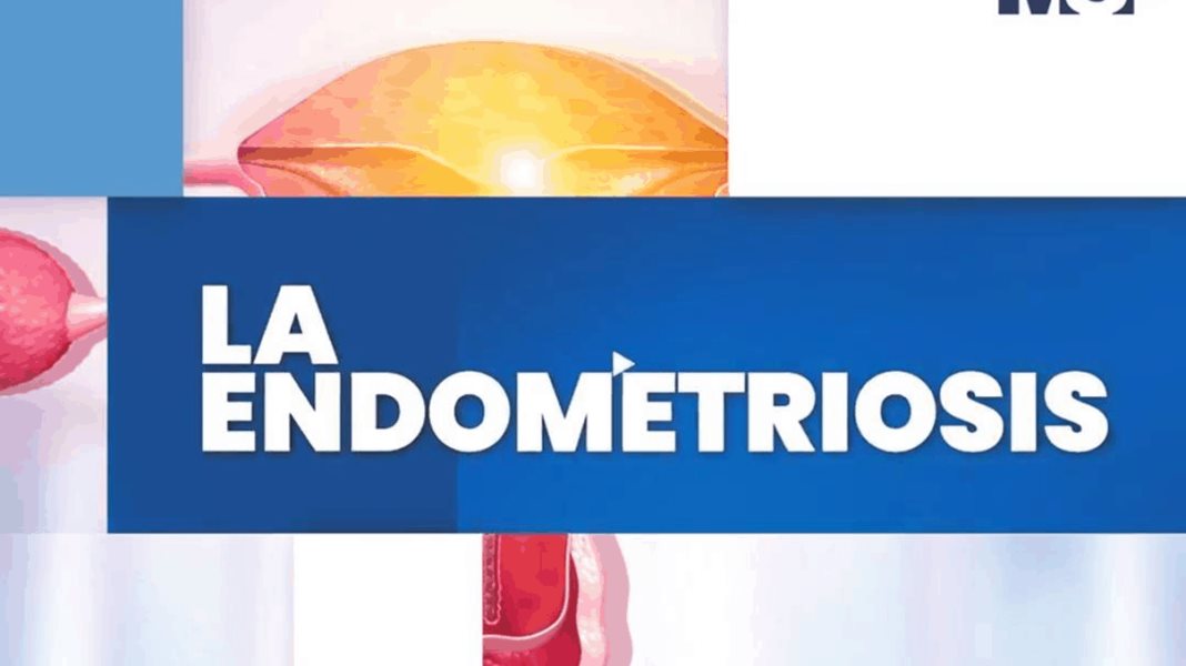 La endometriosis