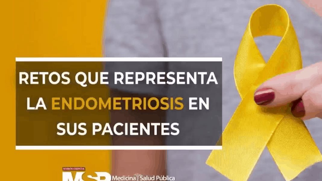Retos que presenta la endometriosis en los pacientes