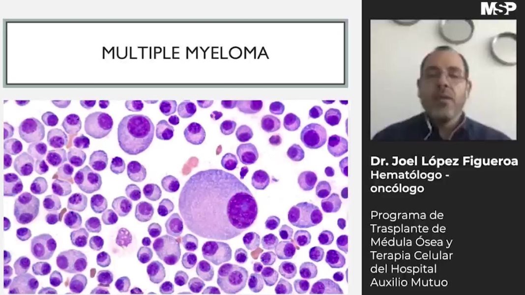 Mieloma Múltiple