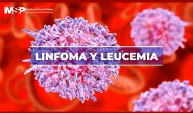 Dr. Alexis Cruz Chacón Linfoma y leucemia