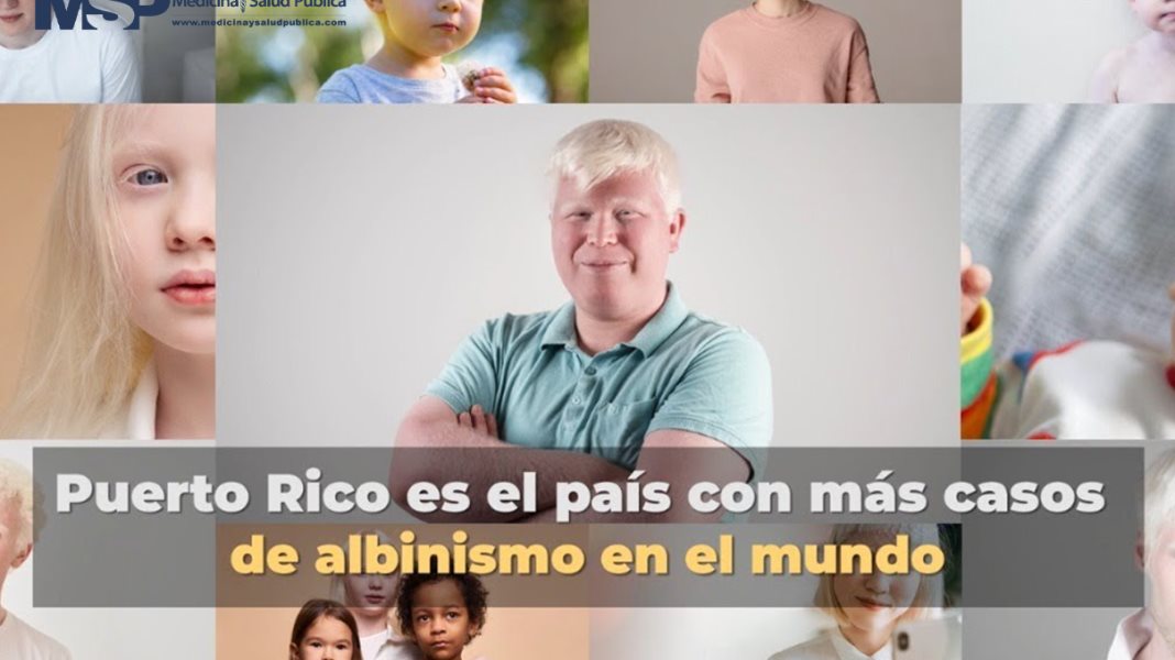 Puerto Rico es el país con más casos de albinismo en el mundo