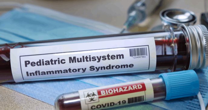 Síndrome inflamatorio grave en niños contagiados con COVID-19