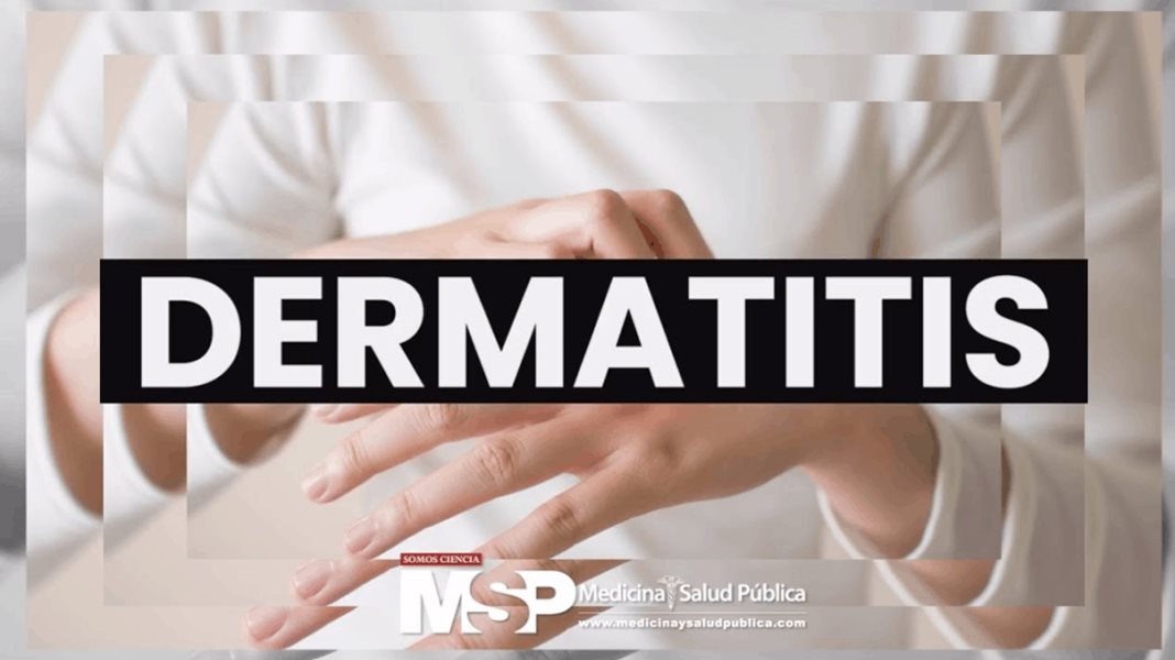 Dermatitis