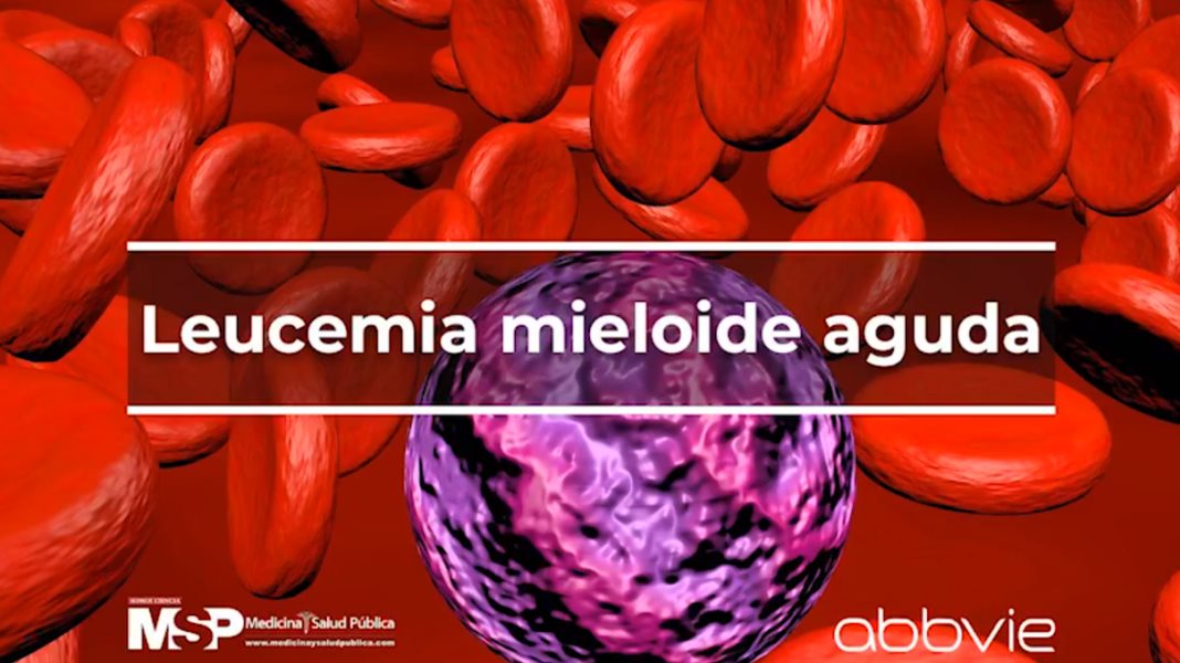 Leucemia Mieloide aguda