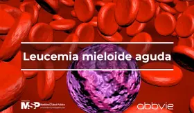 Leucemia Mieloide aguda
