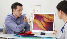 Identifican proteína que bloquea capacidad del organismo para eliminar el colesterol LDL