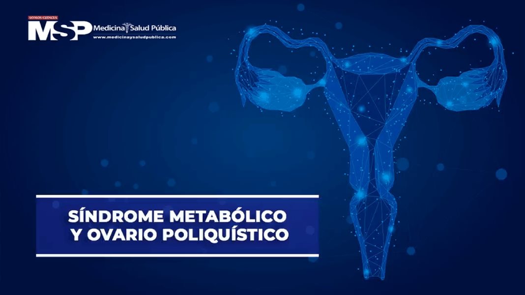 Síndrome Metabólico y ovario poliquístico