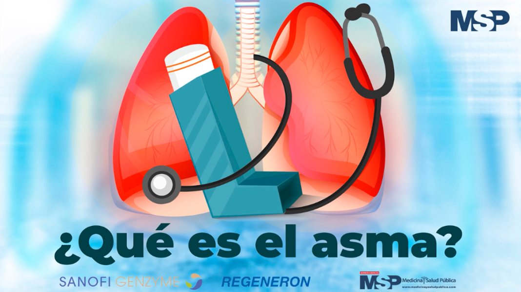 ¿Qué es el asma?