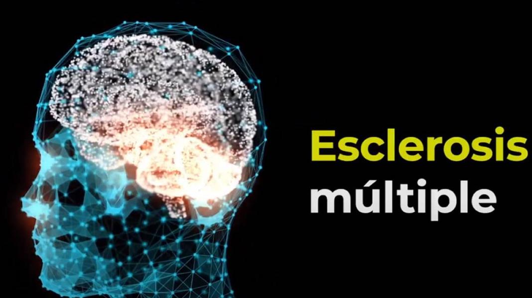 Esclerosis múltiple - Video informativo