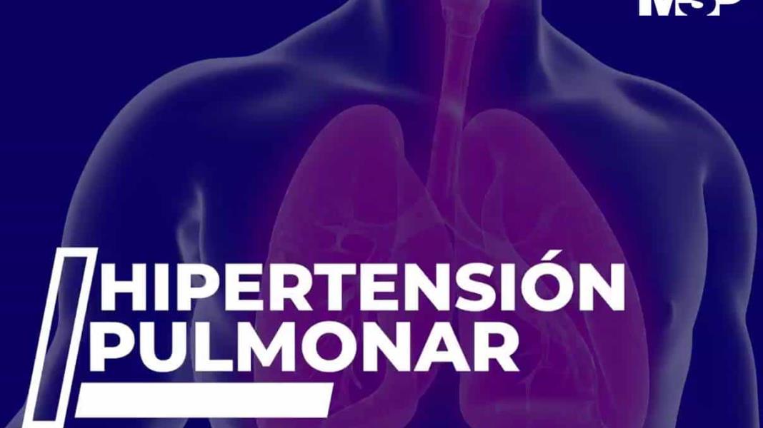 Hipertensión pulmonar