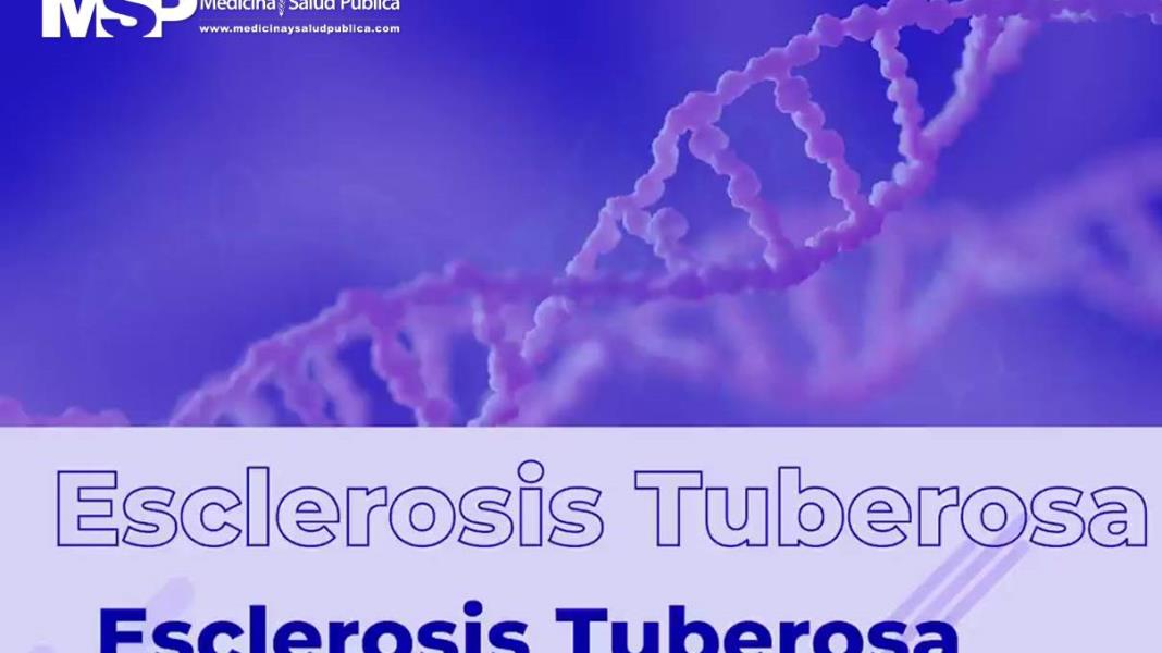 Esclerosis Tuberosa