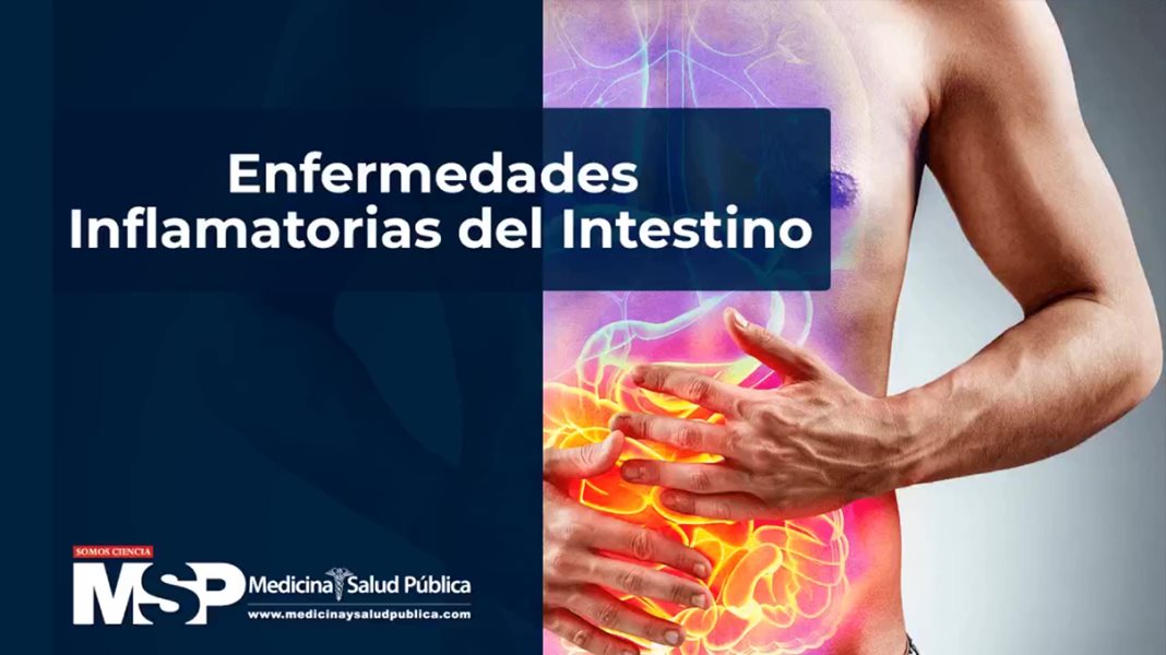 Enfermedades Inflamatorias del Intestino 