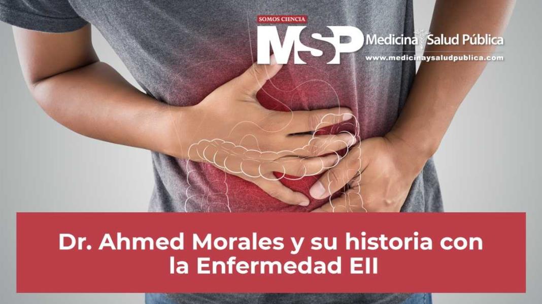Experiencia con Colitis Ulcerativa