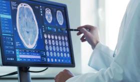 Neuroimagen en Enfermedades Neurodegenerativas