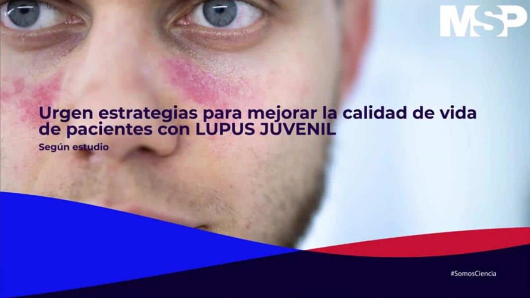Urgen estrategias para mejorar la calidad de vida de pacientes con Lupus Juvenil