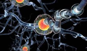 Diagnóstico y tratamiento de Esclerosis Múltiple