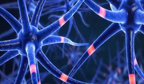 Identificación de fenotipos cognitivos de Esclerosis Múltiple