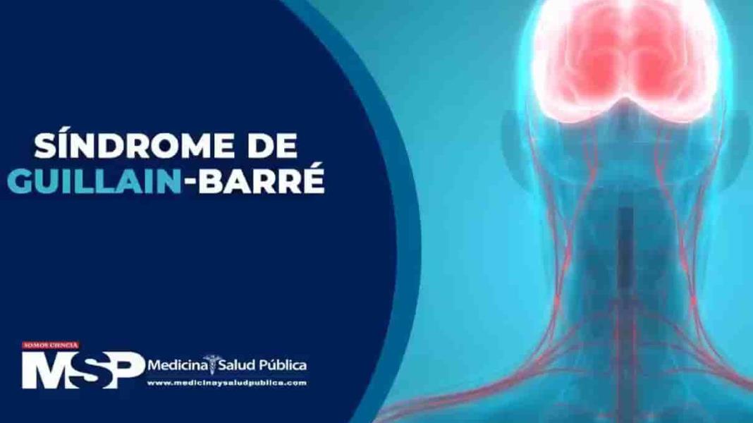 Dr. Carlos Luciano - Síndrome de Guillain-Barré