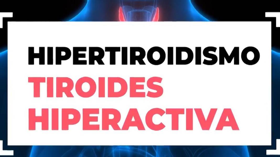 Hipertiroidismo