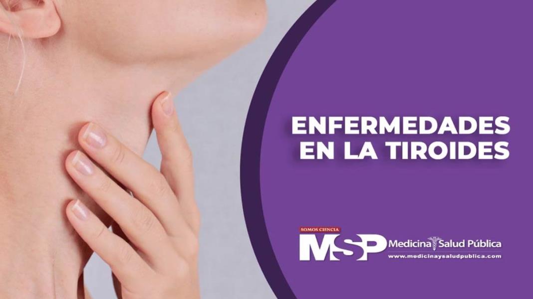 Enfermedades de la Tiroides