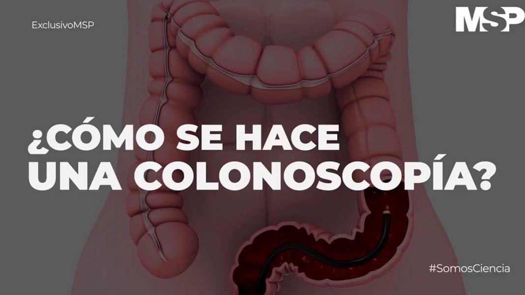 ¿Cómo se hace una colonoscopía?