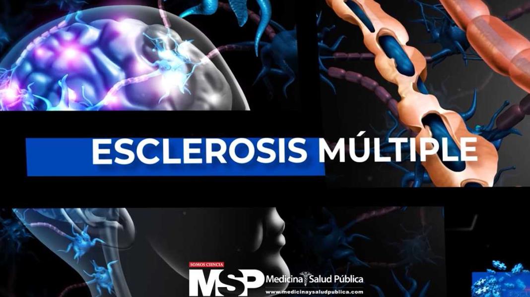 Esclerosis Múltiple