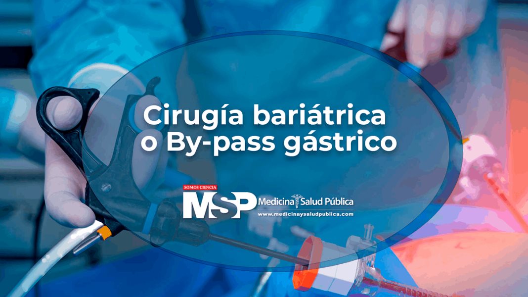 Cirugía bariátrica o By-pass gástrico