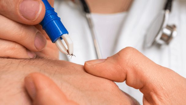 Enfermedad de Lyme: las últimas directrices sobre pruebas, profilaxis y tratamiento Enfermedad de Lyme: las últimas directrices sobre pruebas, profilaxis y tratamiento