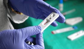 El tratamiento temprano contra el VIH podría revertir el envejecimiento prematuro