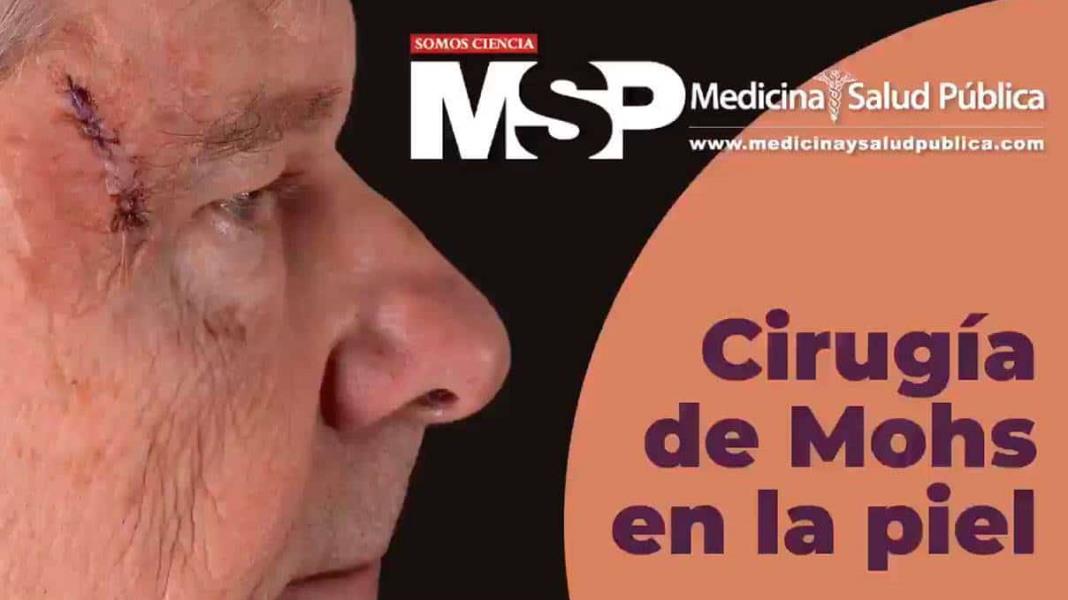 Dra. Sheila Valentín - cirugía de Mohs