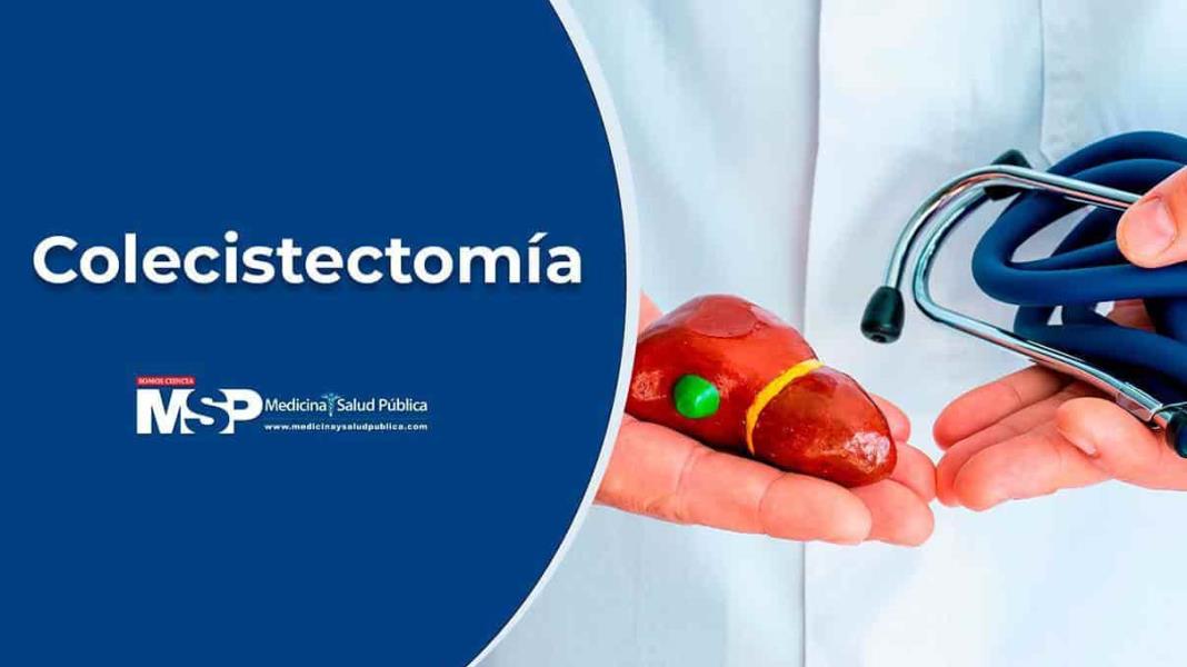 Colecistectomía