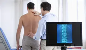 Espondilitis Anquilosante: más que un simple dolor en la espalda