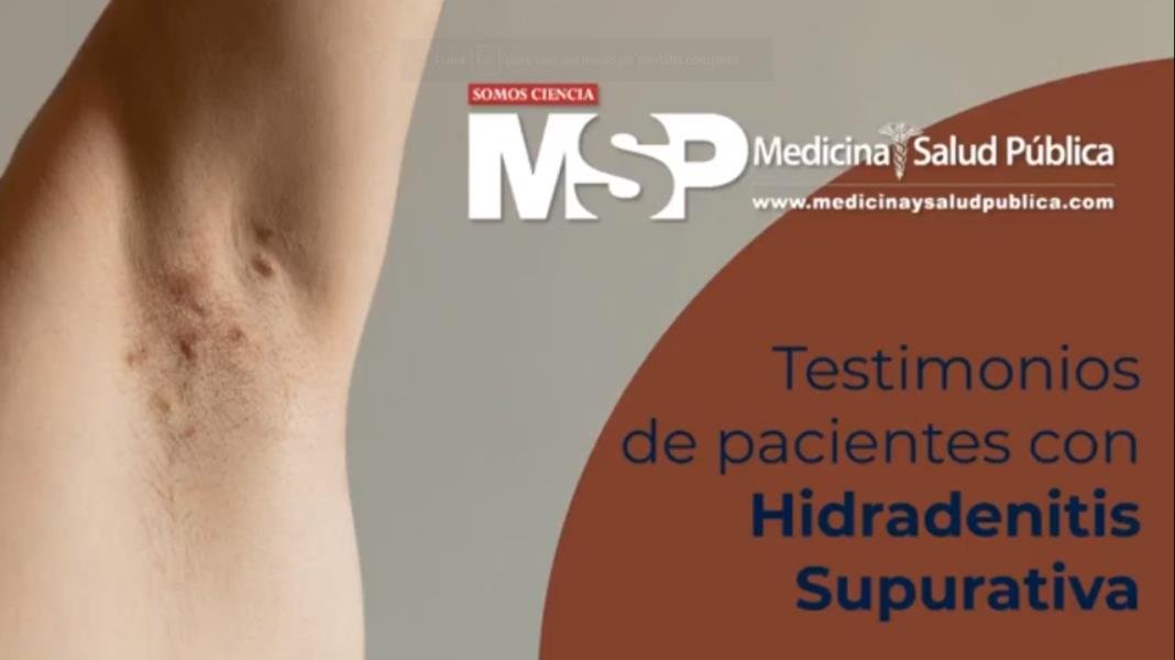 Pacientes narran su historia: Viviendo con Hidradenitis Supurativa