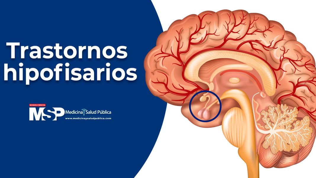 Trastornos hipofisarios - Dr. Raúl Ibarra Salce